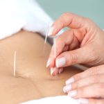 EKB Acupuncture