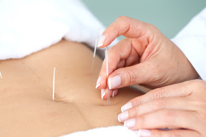 EKB Acupuncture