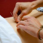 Source Point Community Acupuncture