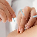 OC Acupuncture Treatment Center