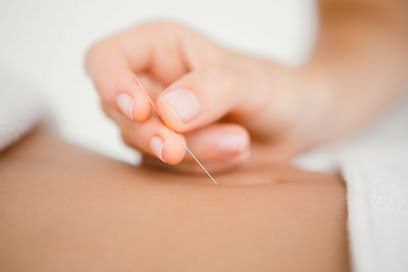 Kd Acupuncture Therapy