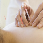 Cho Acupuncture & Herbal Clinic