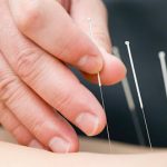 Redwood Acupuncture