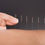 Helios Acupuncture Clinic