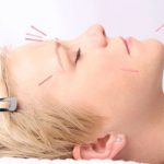 American Acupuncture