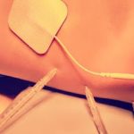 Acupuntura LA ALTERNATIVA