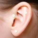 Acupuntura China Y Auriculoterapia Para Tu Bienestar