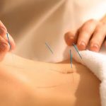 Centro de Acupuntura +Salud
