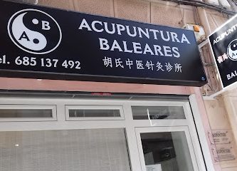 Acupuntura Baleares