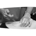 Médico Acupuntor María José Corvinos