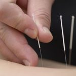 Acupuntura Zhào Lù