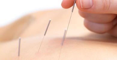 Acupunctura Dr Cai