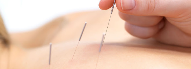 Acupunctura Dr Cai